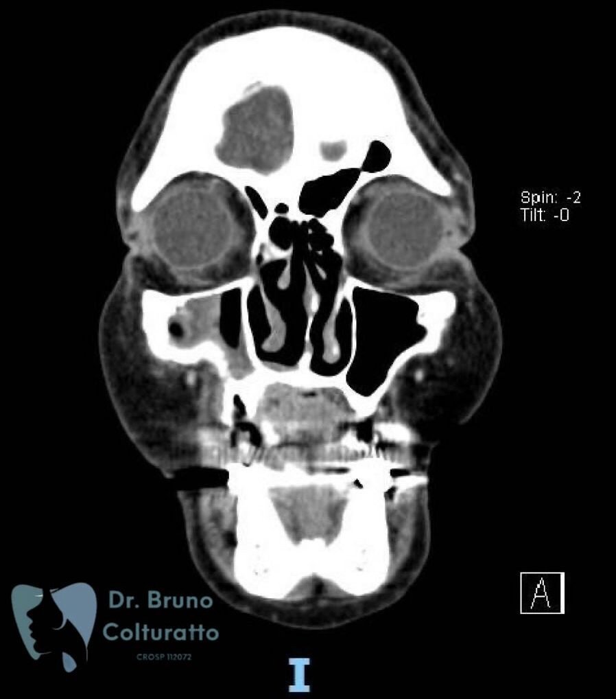 Instagram post from drbrunocolturatto. This post is in position 0.