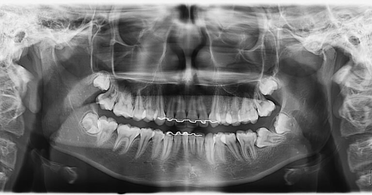 Instagram post from drbrunocolturatto. This post is in position 15.