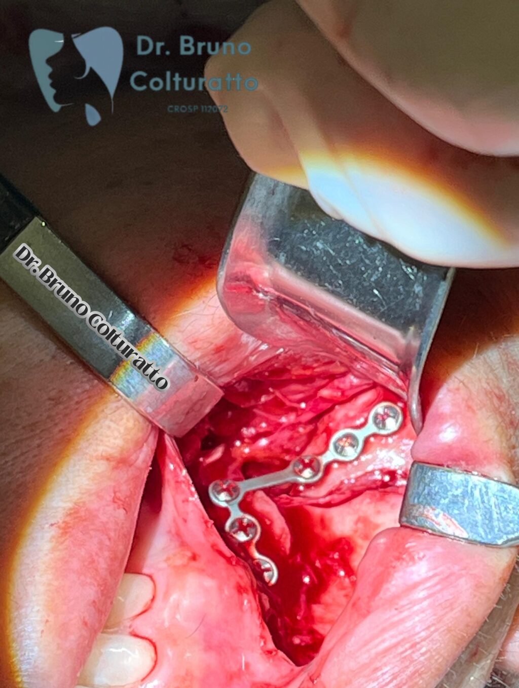 Instagram post from drbrunocolturatto. This post is in position 3.