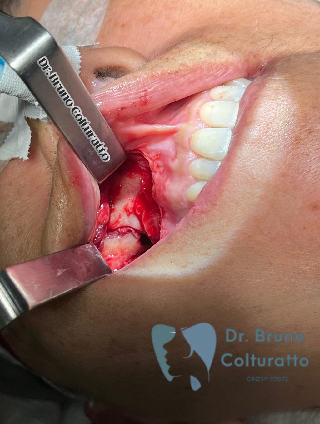 Instagram post from drbrunocolturatto. This post is in position 1.