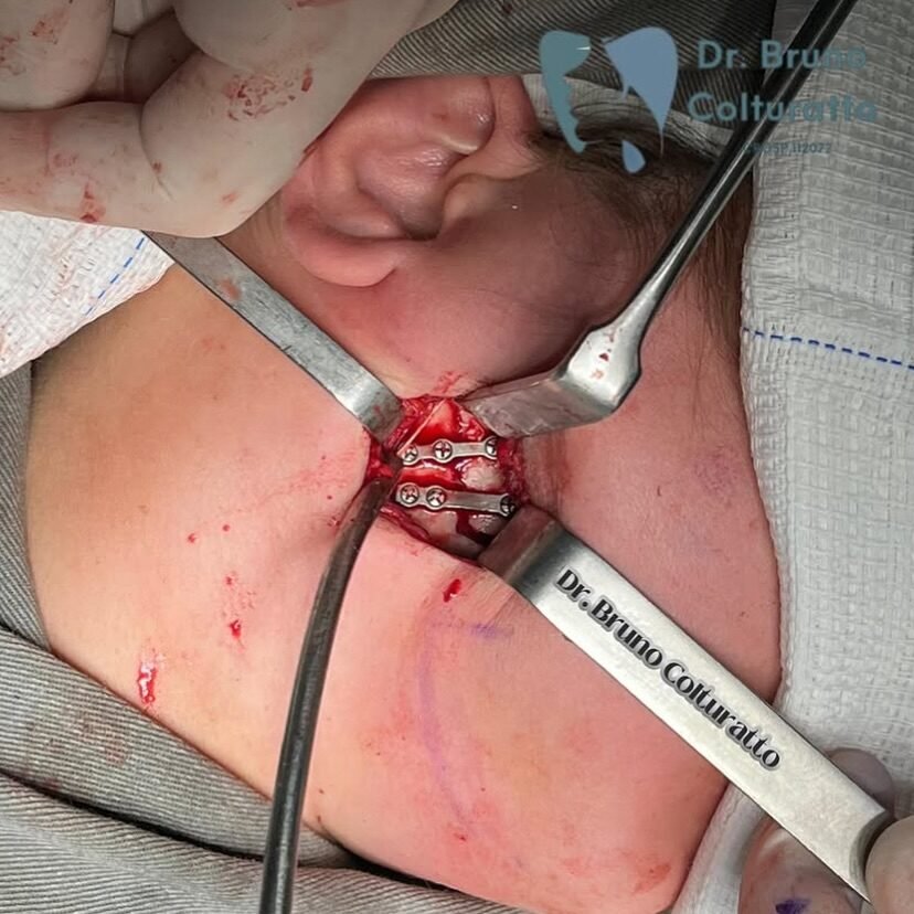 Instagram post from drbrunocolturatto. This post is in position 2.