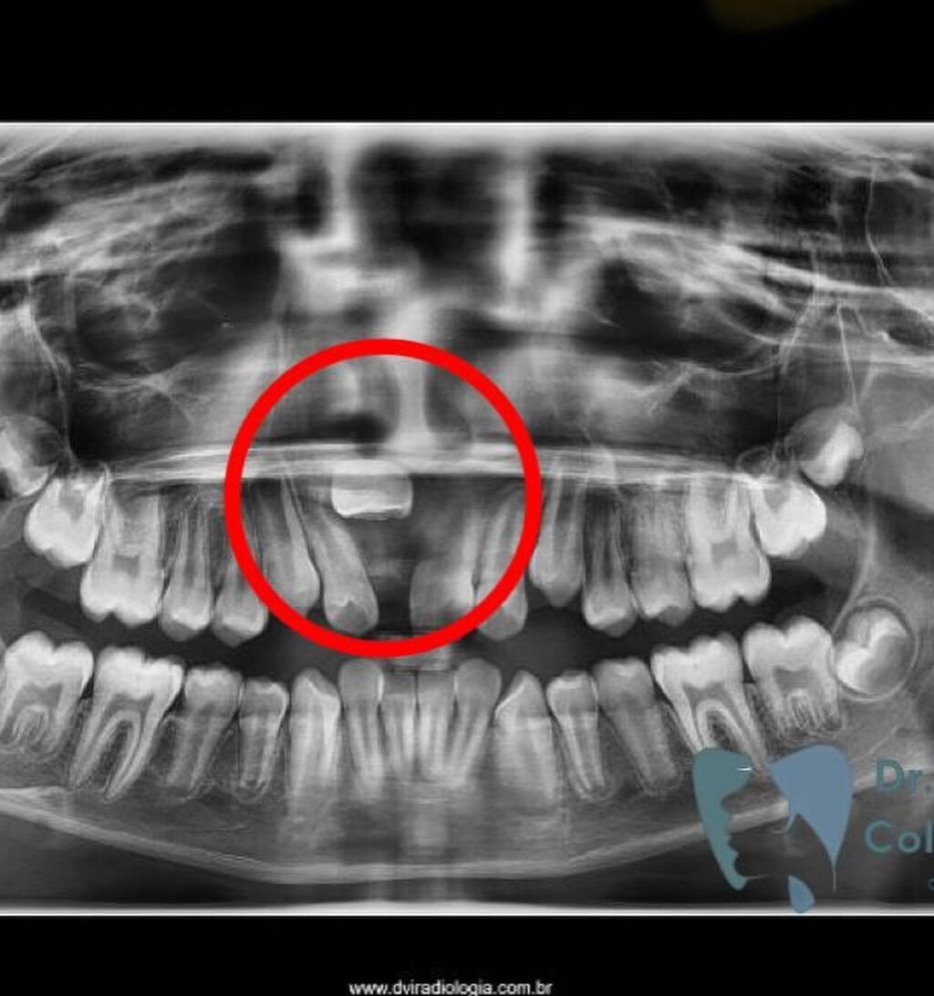 Instagram post from drbrunocolturatto. This post is in position 2.