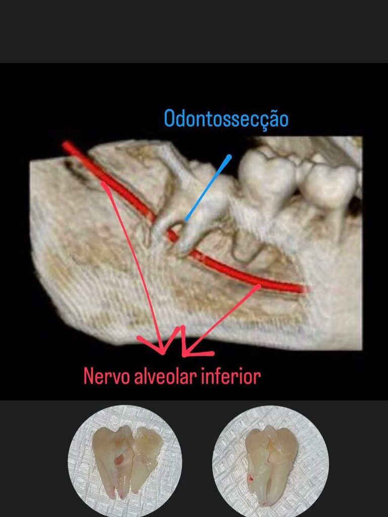 Instagram post from drbrunocolturatto. This post is in position 2.