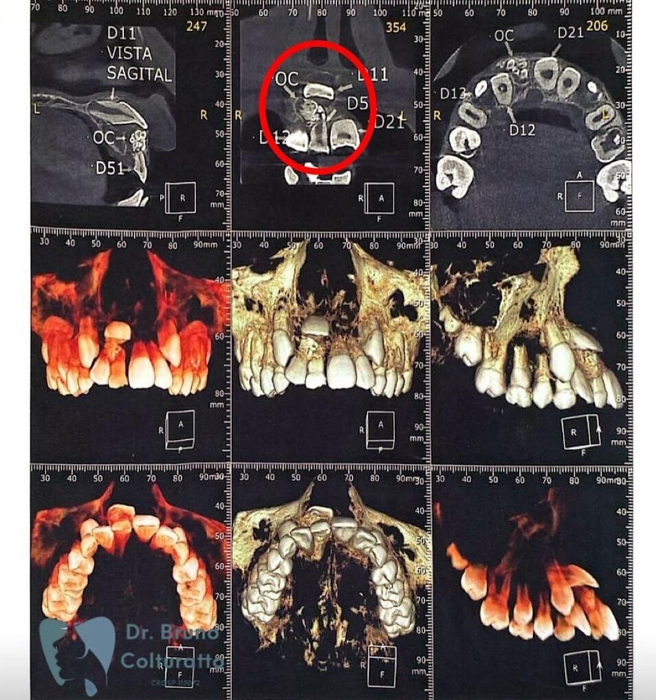 Instagram post from drbrunocolturatto. This post is in position 0.