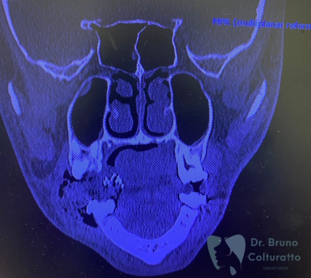 Instagram post from drbrunocolturatto. This post is in position 0.