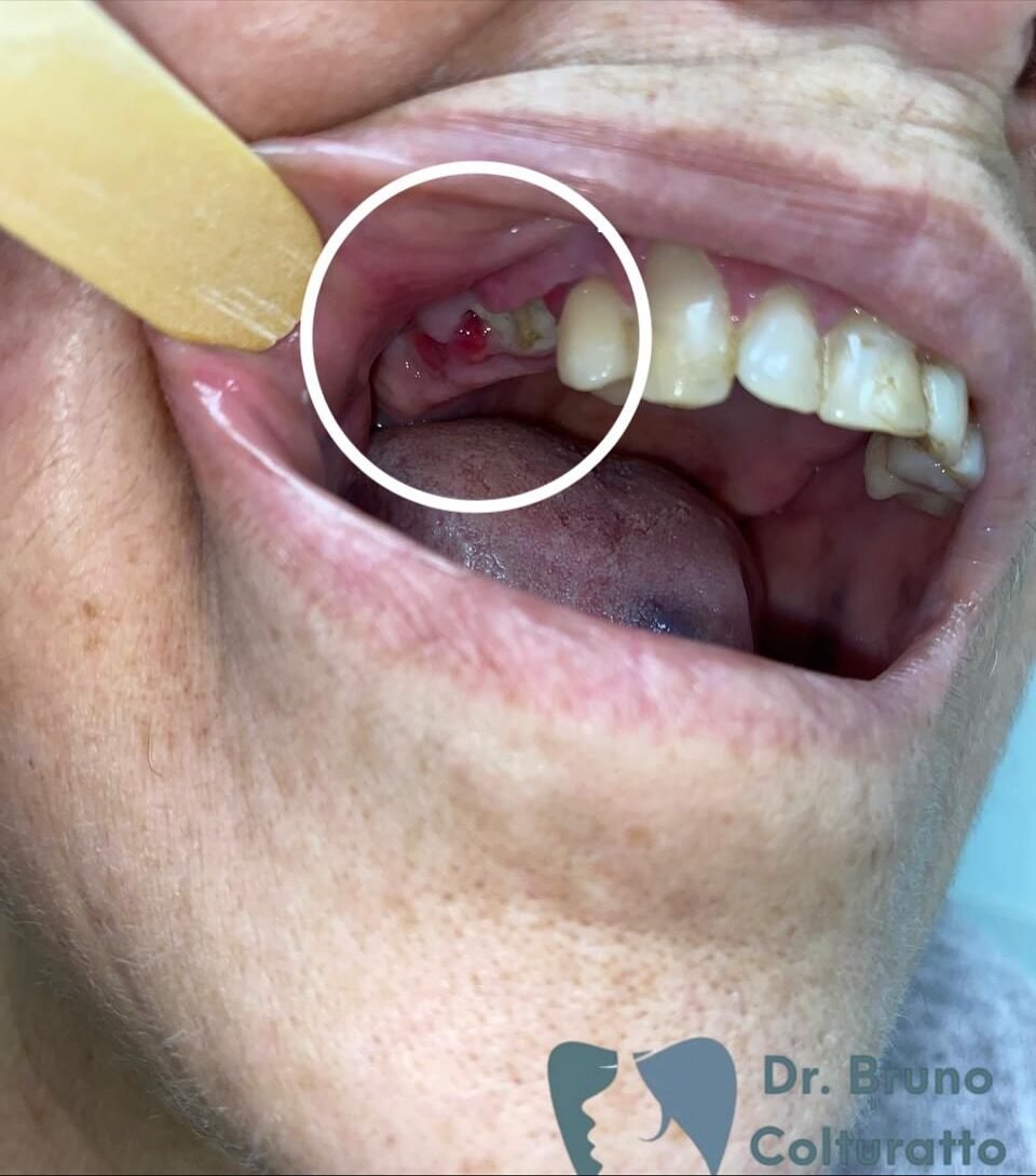 Instagram post from drbrunocolturatto. This post is in position 2.