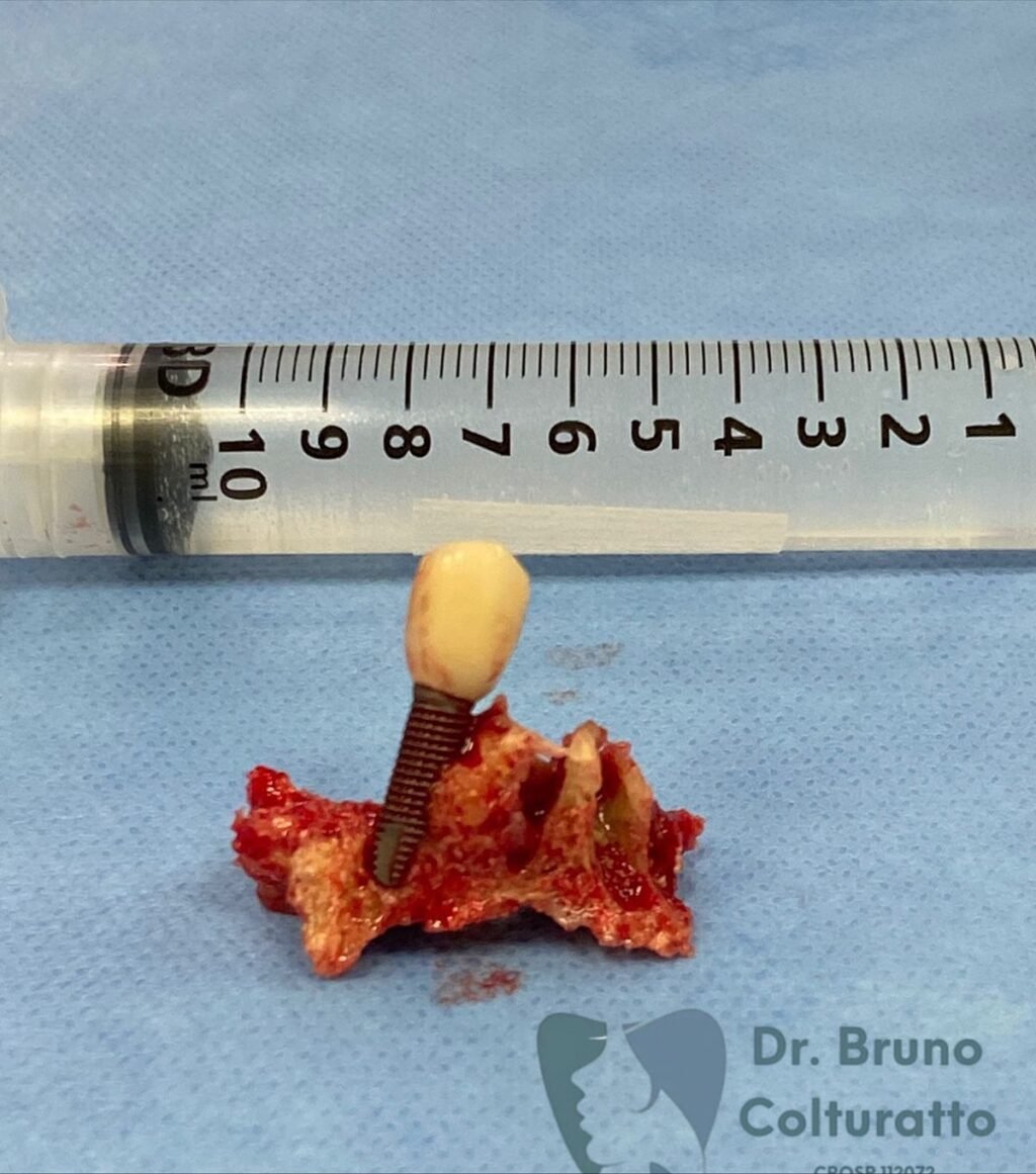 Instagram post from drbrunocolturatto. This post is in position 4.