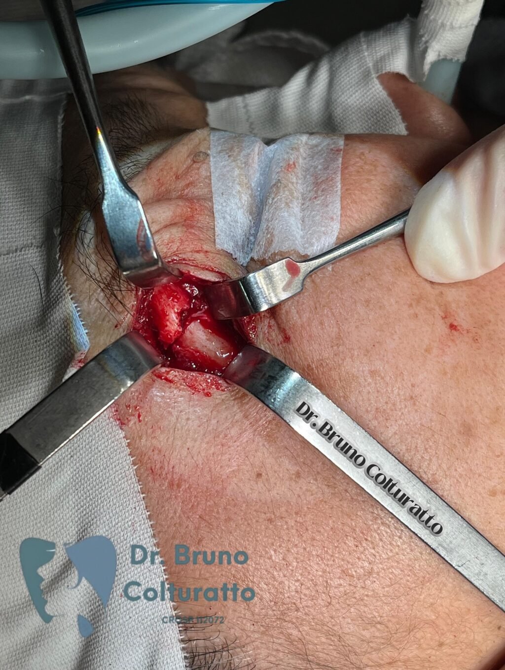 Instagram post from drbrunocolturatto. This post is in position 2.