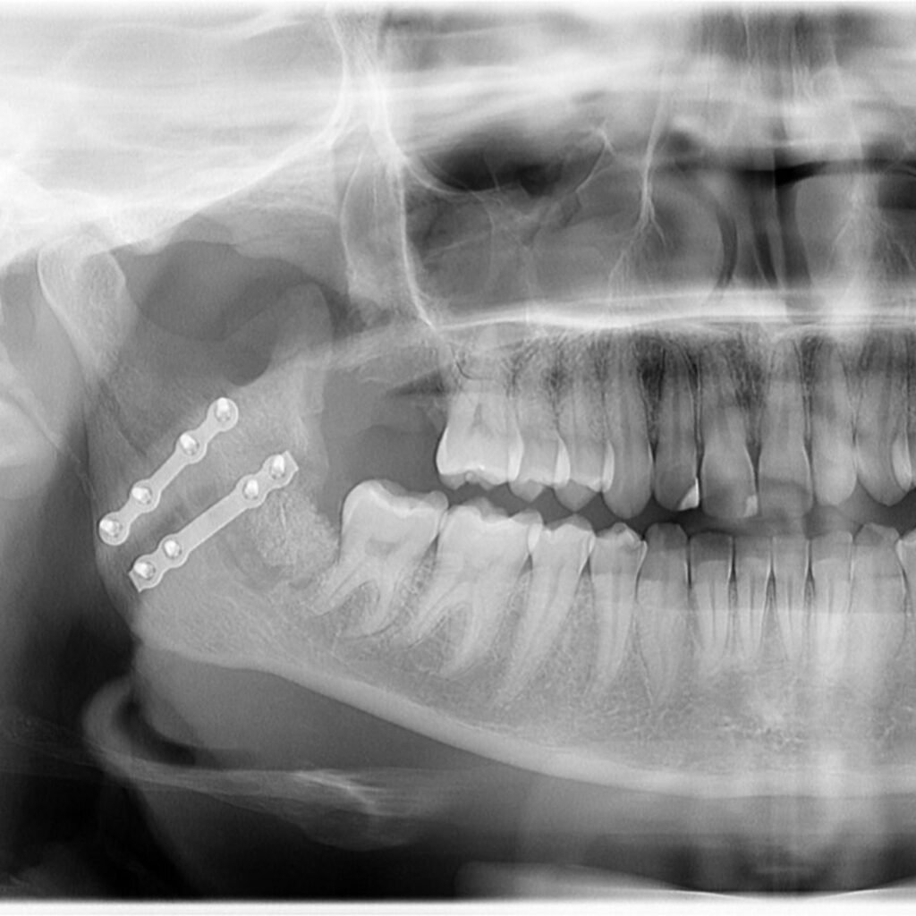 Instagram post from drbrunocolturatto. This post is in position 4.