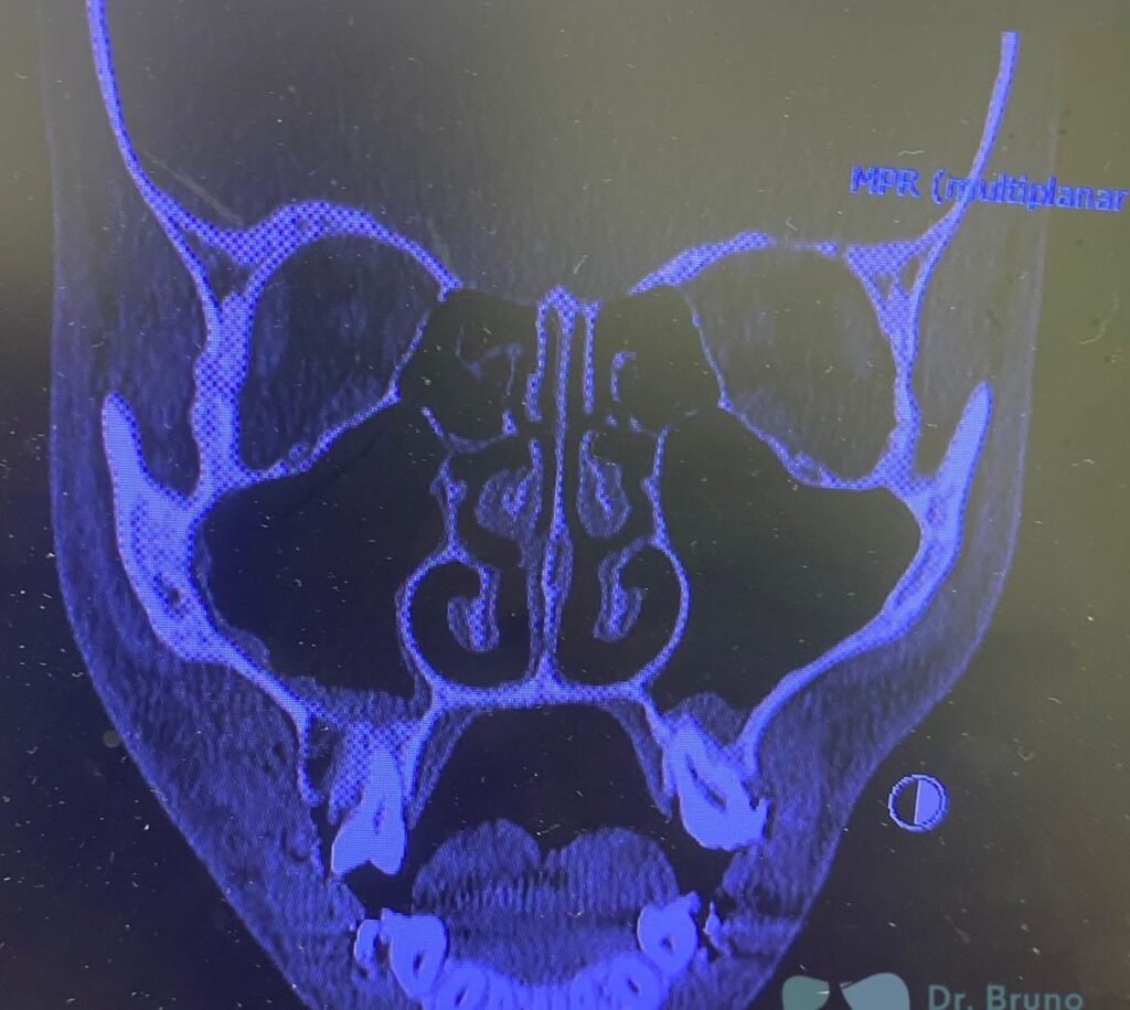 Instagram post from drbrunocolturatto. This post is in position 2.