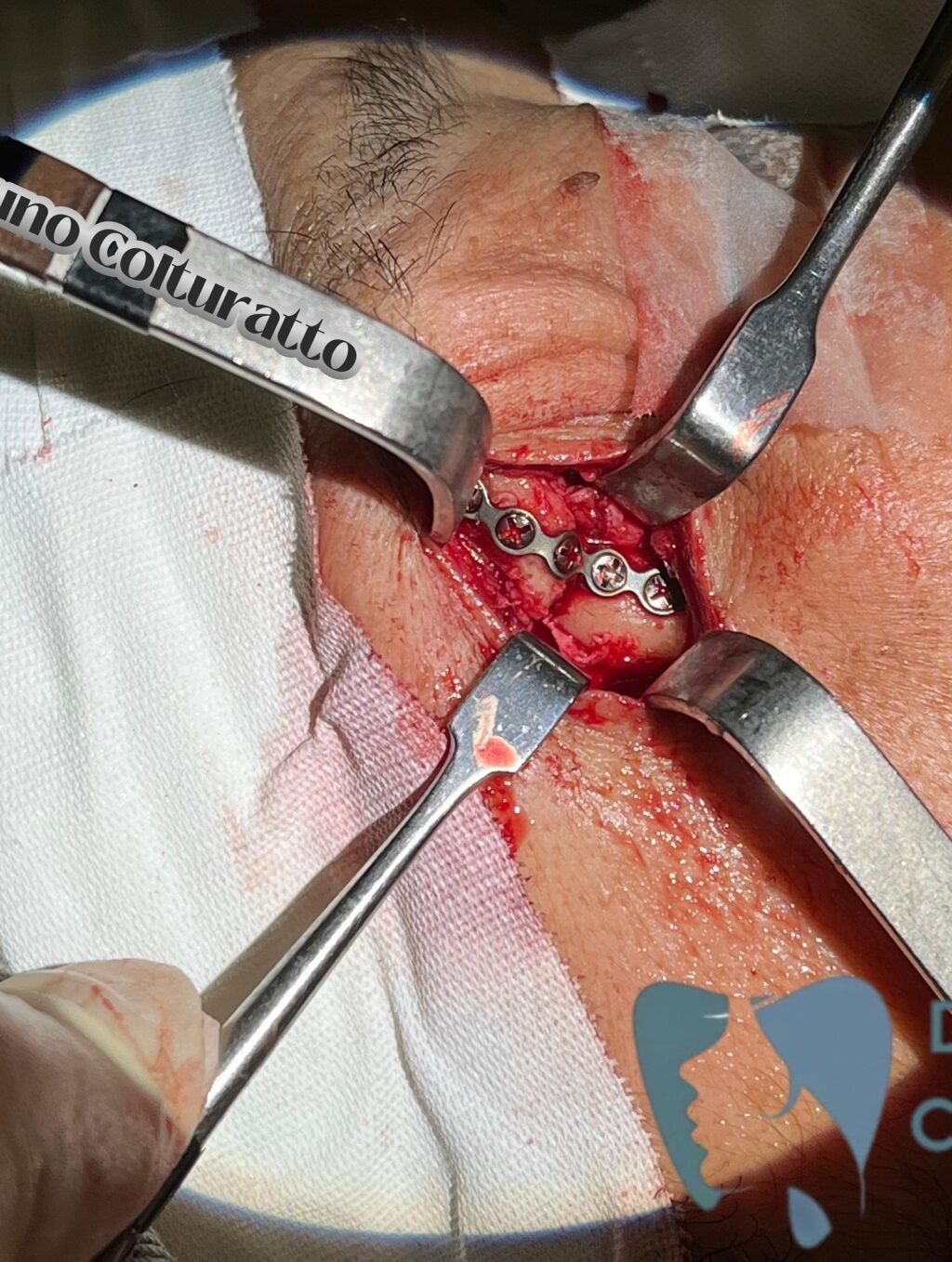 Instagram post from drbrunocolturatto. This post is in position 4.