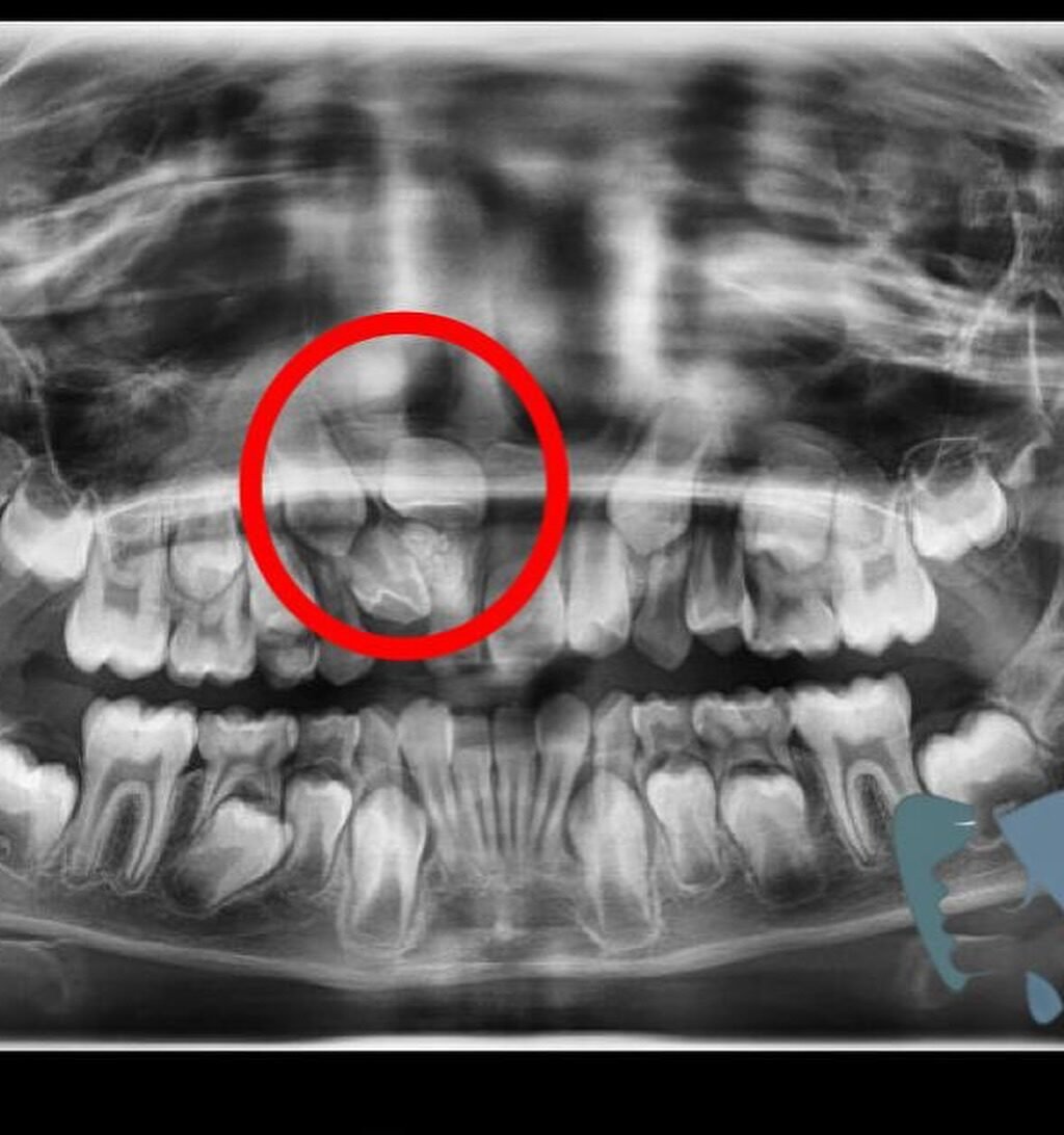 Instagram post from drbrunocolturatto. This post is in position 1.