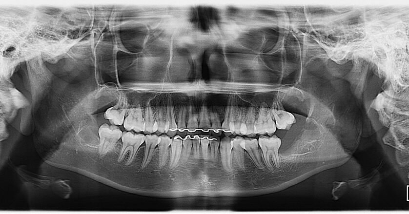 Instagram post from drbrunocolturatto. This post is in position 1.