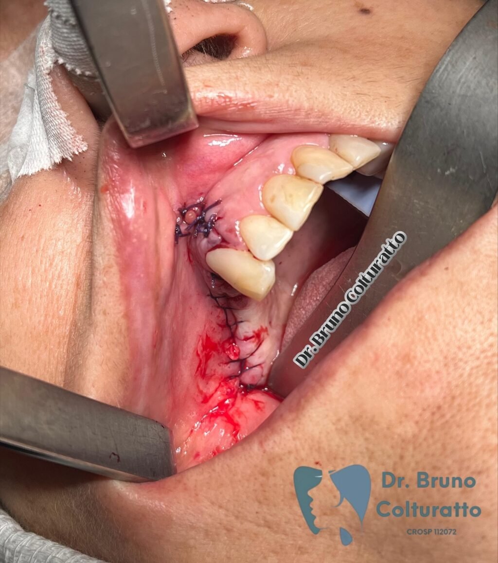 Instagram post from drbrunocolturatto. This post is in position 8.