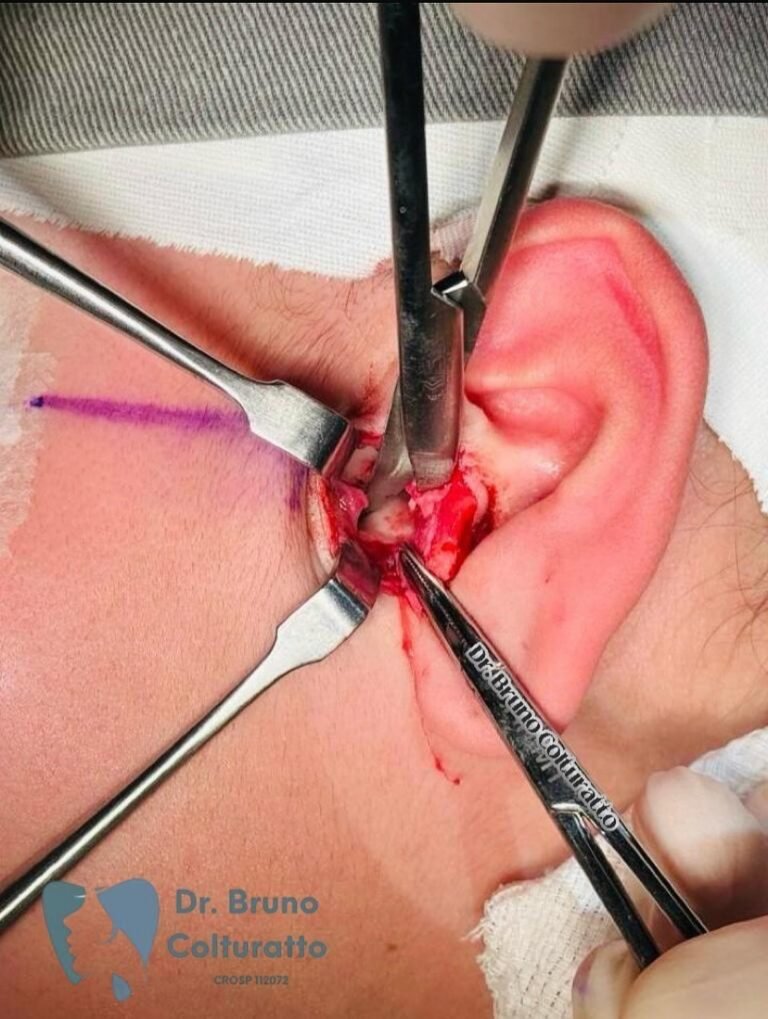 Instagram post from drbrunocolturatto. This post is in position 7.