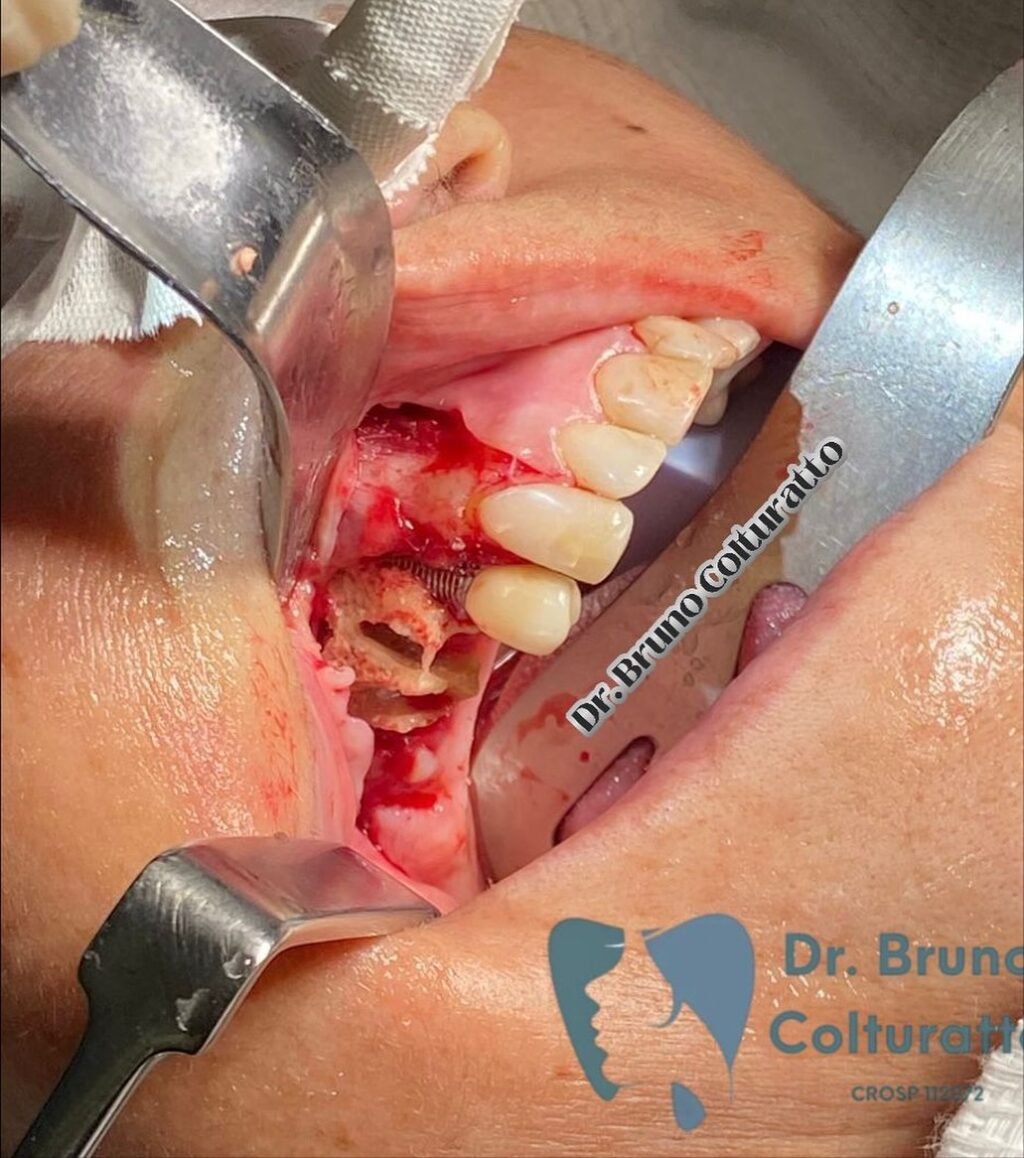 Instagram post from drbrunocolturatto. This post is in position 3.