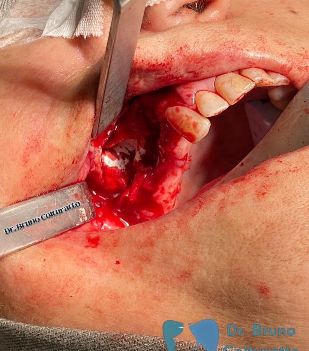 Instagram post from drbrunocolturatto. This post is in position 7.