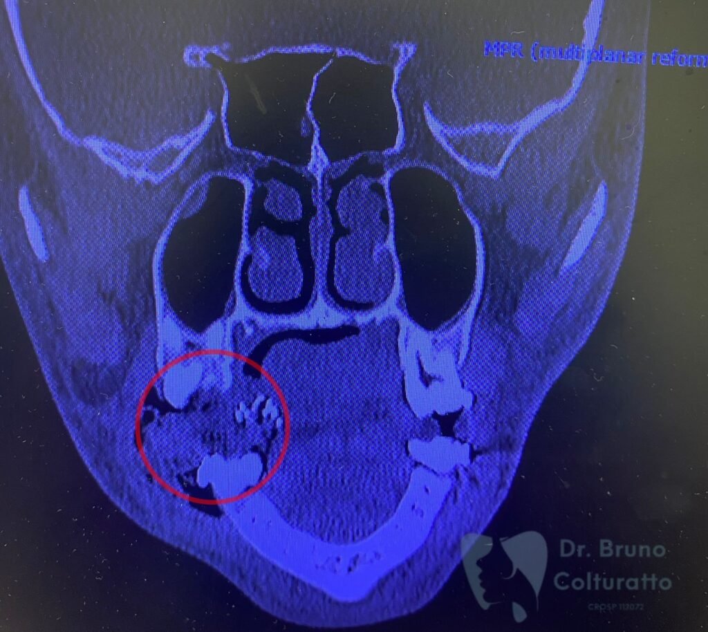 Instagram post from drbrunocolturatto. This post is in position 1.