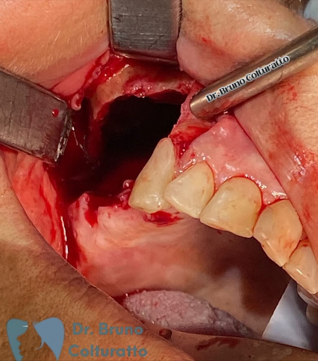 Instagram post from drbrunocolturatto. This post is in position 5.