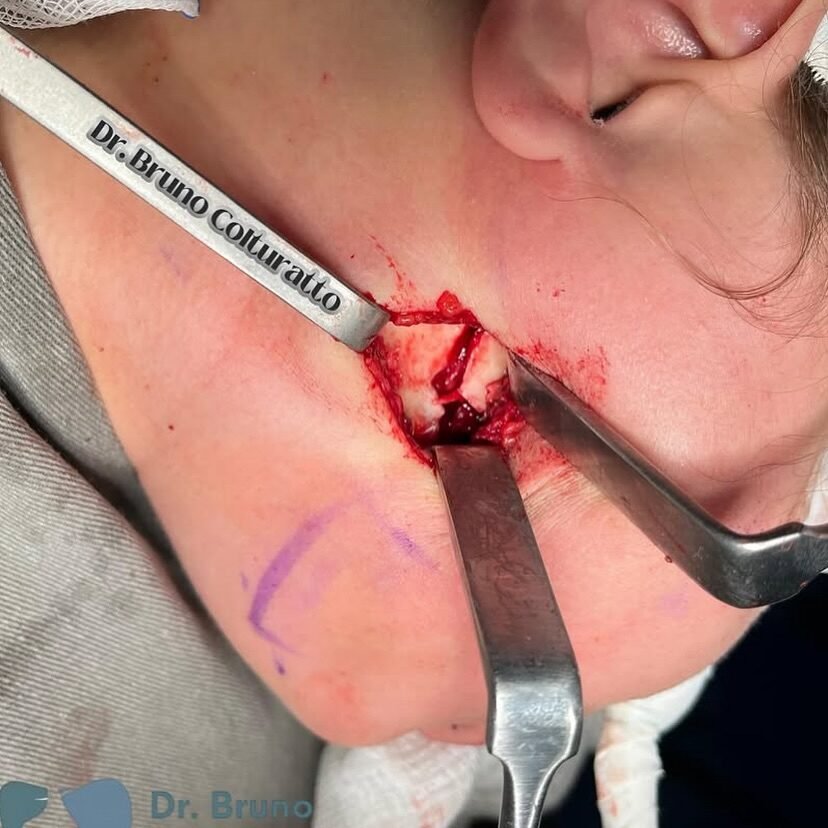 Instagram post from drbrunocolturatto. This post is in position 1.