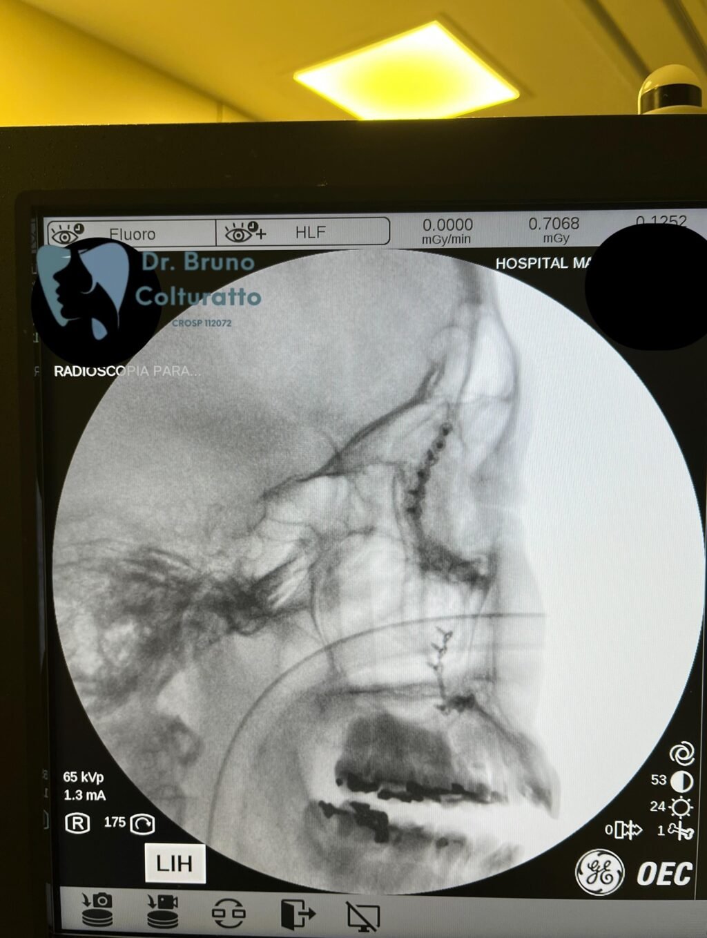 Instagram post from drbrunocolturatto. This post is in position 5.